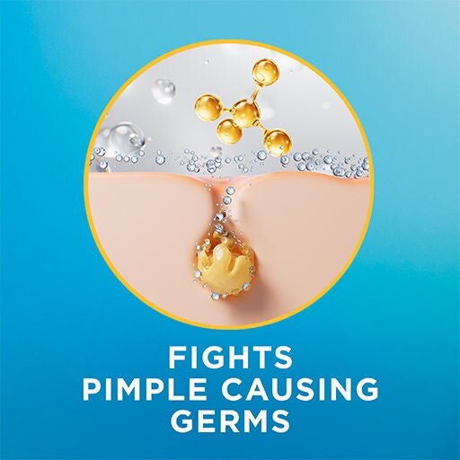 Fights pimple causing germs